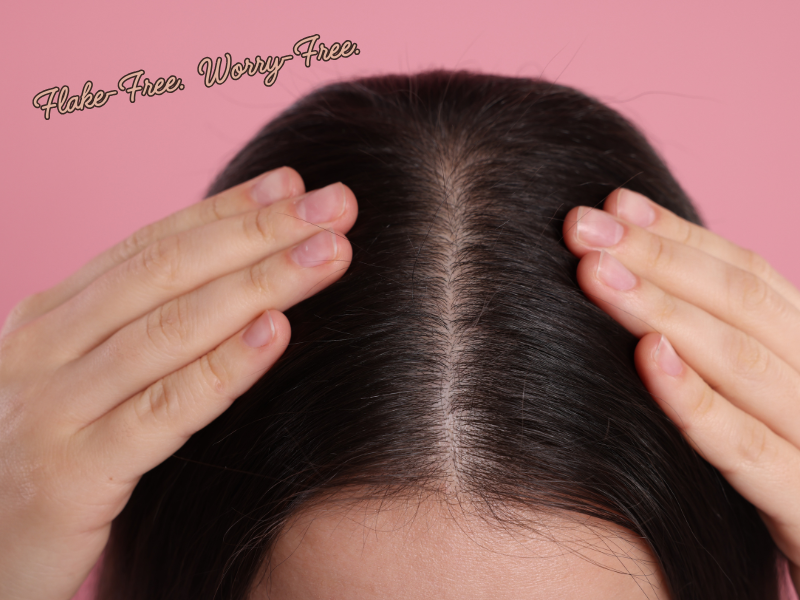 Close-up of healthy, flake-free scalp with hands parting the hair—ideal for promoting dandruff control, scalp health, and clean beauty solutions.