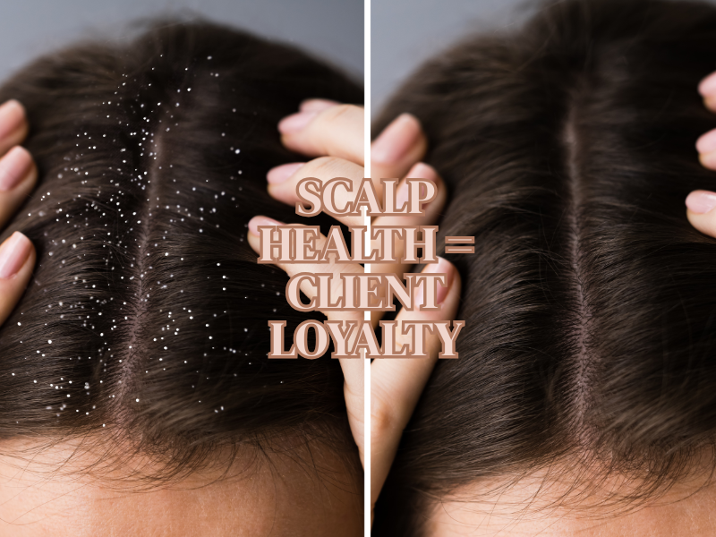Split image showing flaky scalp next to healthy, flake-free scalp—ideal for promoting scalp treatments, salon trust, and natural haircare results.