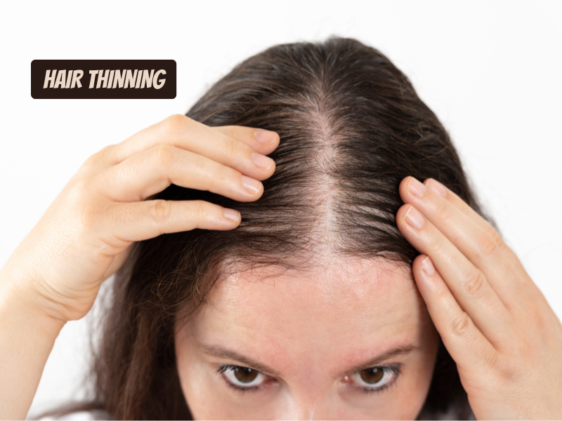 Close-up of woman parting hair to reveal thinning scalp—highlighting signs of hair loss, hair thinning concerns, and scalp health issues.
